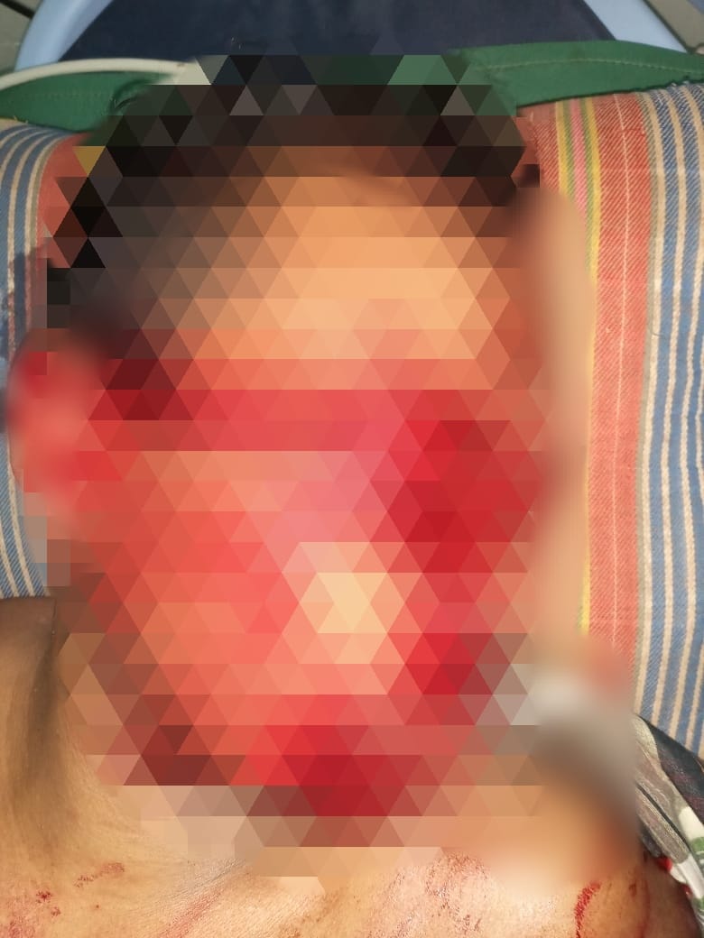 Polresta Pati berhasil mengungkap dan mengamankan pelaku tindak pidana dugaan kekerasan yang menimpa N (44) warga Dukuh Gading Desa Pondowan Rt 01 RW 04 Kecamatan Tayu Kabupaten Pati