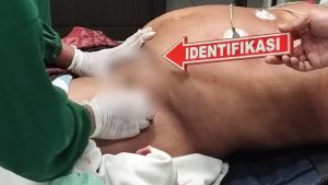 Kedua pelaku kini ditahan di Sat Reskrim Polresta Pati dan menyita barang bukti berupa pisau lipat stanliss, kaos warna merah dan kaos hitam terdapat bercak darah.