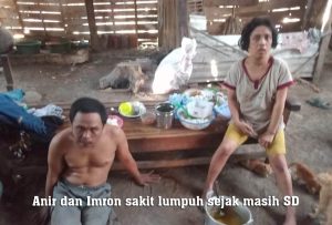 Anir dan Imron warga Desa Sumberagung Banjarejo sakit lumpuh.